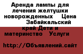 Аренда лампы для лечения желтушки новорожденных  › Цена ­ 600 - Забайкальский край Дети и материнство » Услуги   